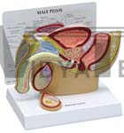 Male Pelvis cross-section including a testicle with cancer